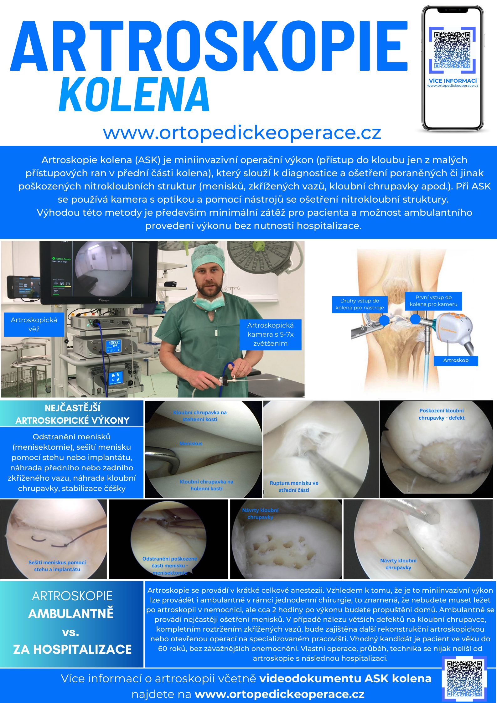 Informace o artroskopii kolena