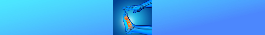 Ztuhlý palec na noze neboli hallux rigidus: Příčiny, diagnostika a léčba